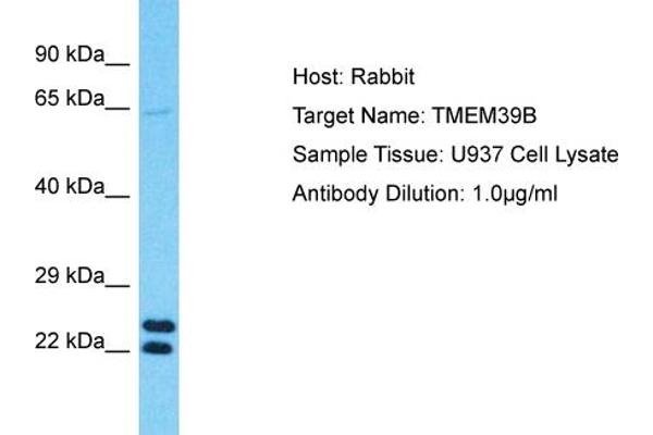 TMEM39B anticorps  (N-Term)