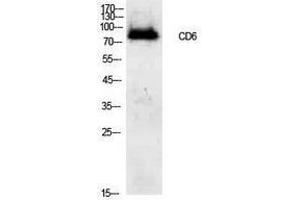 Image no. 1 for anti-CD6 (CD6) (Internal Region) antibody (ABIN3181430)