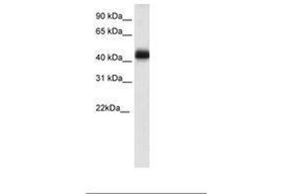 NK2 Homeobox 4 抗体  (C-Term)