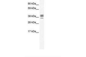 Image no. 1 for anti-ESX Homeobox 1 (ESX1) (N-Term) antibody (ABIN202219)