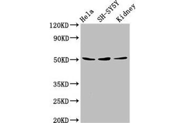 Retinoic Acid Receptor gamma antibody  (AA 13-87)