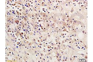 Formalin-fixed and paraffin embedded: rat brain tissue labeled with Anti-SOCS 1 Polyclonal Antibody (ABIN725135), Unconjugated 1:200 followed by conjugation to the secondary antibody and DAB staining