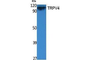 Western Blotting (WB) image for anti-Transient Receptor Potential Cation Channel, Subfamily V, Member 4 (TRPV4) (Internal Region) antibody (ABIN3178074)