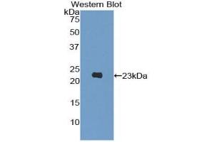 PIK3CB antibody  (AA 321-507)