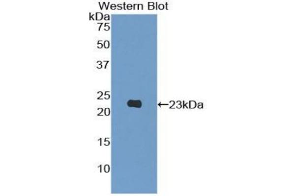 PIK3CB anticorps  (AA 321-507)