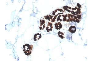 Image no. 5 for anti-Keratin 15 (KRT15) antibody (ABIN6939912)