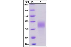 Image no. 2 for Placenta Growth Factor (PGF) (AA 19-158) (Active) protein (His tag) (ABIN6253571)