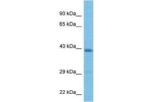 Image no. 3 for anti-Lysosomal Protein Transmembrane 4 beta (LAPTM4B) (Middle Region) antibody (ABIN2782966)
