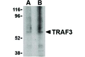 Image no. 1 for anti-TNF Receptor-Associated Factor 3 (TRAF3) (C-Term) antibody (ABIN6655864)
