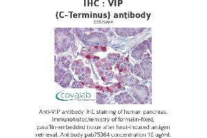 Image no. 1 for anti-Vasoactive Intestinal Peptide (Vip) (C-Term) antibody (ABIN5693743)