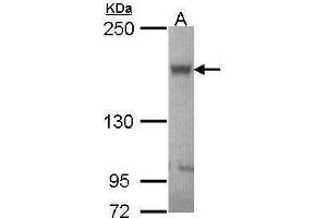 Image no. 2 for anti-ATP-Binding Cassette, Sub-Family B (MDR/TAP), Member 11 (ABCB11) (Internal Region) antibody (ABIN2855437)