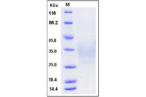 Image no. 1 for CD79b Molecule, Immunoglobulin-Associated beta (CD79B) (AA 1-158), (Extracellular Domain) protein (His tag) (ABIN2008278)