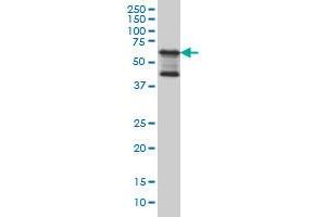 Image no. 3 for anti-TGF-beta Activated Kinase 1/MAP3K7 Binding Protein 1 (TAB1) (AA 3-100) antibody (ABIN564552)