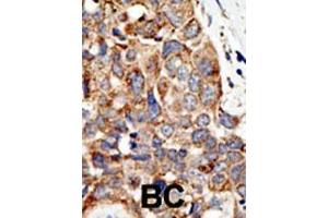 Image no. 1 for anti-Protein Inhibitor of Activated STAT, 4 (PIAS4) (AA 471-499), (C-Term) antibody (ABIN388062)