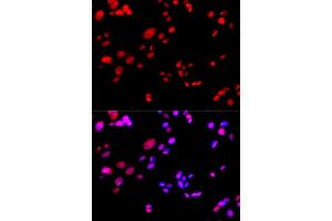 Image no. 2 for anti-Replication Protein A2, 32kDa (RPA2) antibody (ABIN3023166)