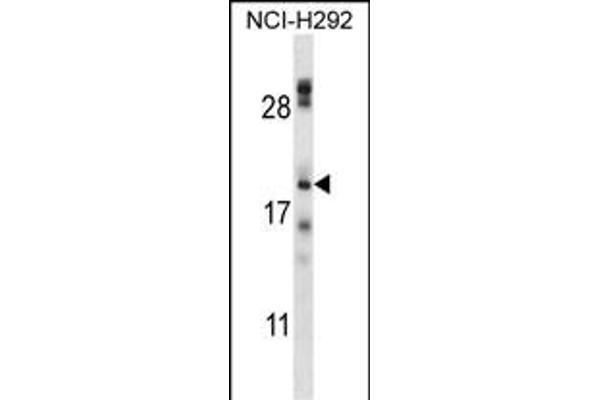TMEM17 抗体  (N-Term)