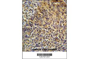 Immunohistochemistry (IHC) image for anti-Ankyrin Repeat Domain 32 (ANKRD32) (N-Term) antibody (ABIN2157723)