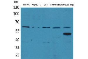 Image no. 1 for anti-Zinc Finger Protein 307 (ZKSCAN4) (Internal Region) antibody (ABIN3187831)