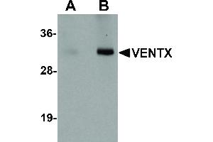 VENTX Antikörper  (Internal Region)