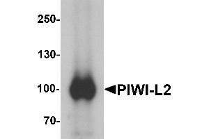 Image no. 1 for anti-Piwi-Like 2 (PIWIL2) (Middle Region) antibody (ABIN1031041)