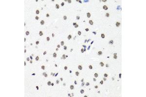 Image no. 3 for anti-Histone H2B Type 1-C/E/F/G/I (LOC100407767) antibody (ABIN4903913)