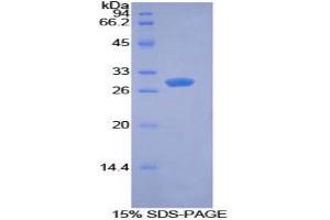 Image no. 1 for Pyruvate Dehydrogenase Kinase 1 (PDK1) protein (ABIN3011408)