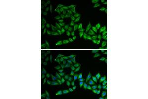 Image no. 1 for anti-Thiopurine S-Methyltransferase (TPMT) antibody (ABIN3021279)