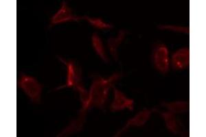S100A1 antibody  (N-Term)
