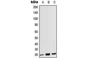Image no. 1 for anti-CD3g Molecule, gamma (CD3-TCR Complex) (CD3G) (Center) antibody (ABIN2705794)