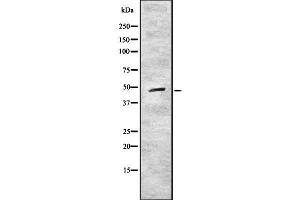 Image no. 1 for anti-Cytokine Receptor-Like Factor 1 (CRLF1) antibody (ABIN6261038)