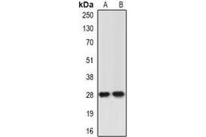 Image no. 1 for anti-Inhibitor of Growth Family, Member 5 (ING5) (full length) antibody (ABIN6043602)
