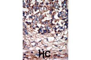 Image no. 1 for anti-NIMA (Never in Mitosis Gene A)- Related Kinase 9 (NEK9) (AA 846-877), (C-Term) antibody (ABIN392654)