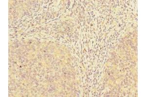 Immunohistochemistry of paraffin-embedded human tonsil tissue using ABIN7173532 at dilution of 1:100