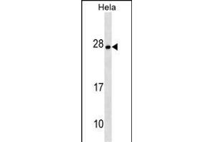 ZT4 Antibody (N-term) (ABIN1538915 and ABIN2849800) western blot analysis in Hela cell line lysates (35 μg/lane).