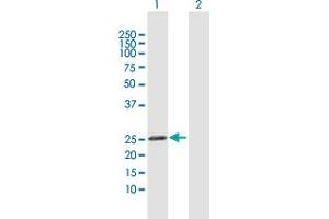 Image no. 3 for anti-Glutathione S-Transferase kappa 1 (GSTK1) (AA 1-226) antibody (ABIN531698)