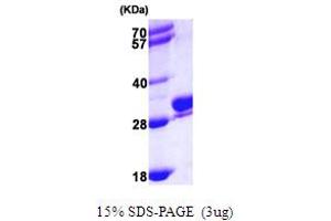 Image no. 1 for RAB27B, Member RAS Oncogene Family (RAB27B) (AA 1-218) protein (His tag) (ABIN667319)