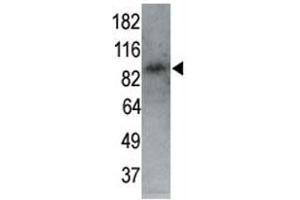 Image no. 3 for anti-MAP/microtubule Affinity-Regulating Kinase 1 (MARK1) (AA 6-40) antibody (ABIN3031687)