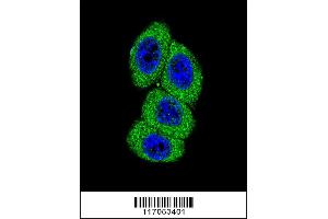 Image no. 3 for anti-Cytochrome P450, Family 4, Subfamily B, Polypeptide 1 (CYP4B1) (AA 331-362) antibody (ABIN652592)
