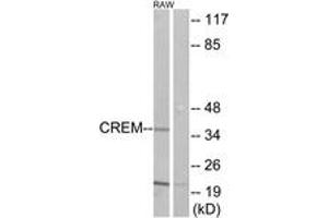 Image no. 1 for anti-CAMP Responsive Element Modulator (CREM) (AA 81-130) antibody (ABIN1533826)