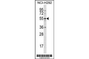anti-C-Type Lectin Domain Family 18, Member A (CLEC18A) (AA 338-367), (C-Term) antibody