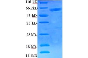 Image no. 1 for BRCA1/BRCA2-Containing Complex, Subunit 3 (BRCC3) (AA 2-316) protein (His-SUMO Tag) (ABIN5709149)