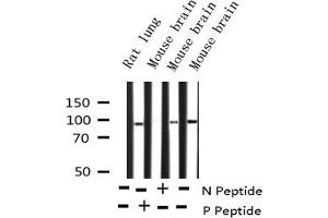 Image no. 3 for anti-Protein Kinase C, delta (PKCd) (pTyr64) antibody (ABIN6256779)