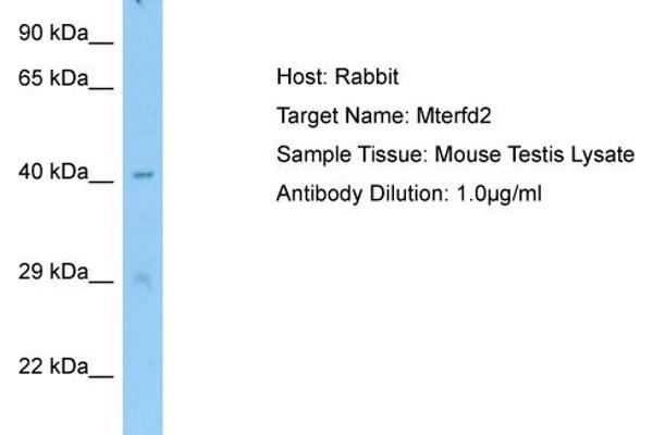 MTERFD2 antibody  (C-Term)