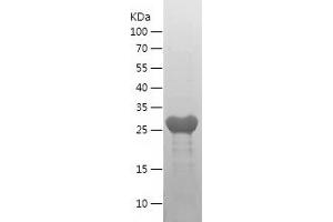 IRF9 Protein (AA 1-220) (His tag)