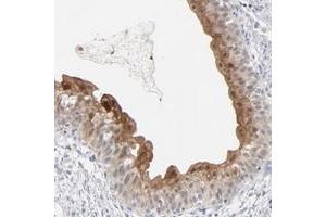 Image no. 1 for anti-Premature Ovarian Failure, 1B (POF1B) antibody (ABIN5585910)
