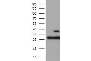 Image no. 2 for anti-Proteasome (Prosome, Macropain) Subunit, beta Type, 7 (PSMB7) (AA 58-277) antibody (ABIN2729938)