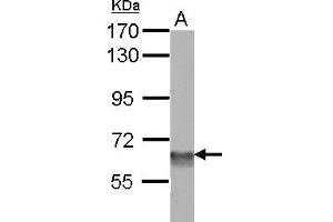 Image no. 2 for anti-SWI/SNF Related, Matrix Associated, Actin Dependent Regulator of Chromatin, Subfamily D, Member 3 (SMARCD3) (AA 105-441) antibody (ABIN1501913)