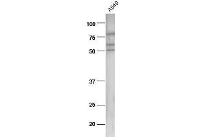 Image no. 2 for anti-Keratin 1 (KRT1) (AA 101-200) antibody (ABIN678488)