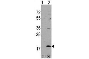 Image no. 3 for anti-Hippocalcin-Like 1 (HPCAL1) (N-Term) antibody (ABIN357110)