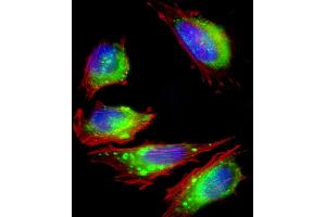 Image no. 6 for anti-Fibroblast Growth Factor Receptor 2 (FGFR2) (AA 22-51), (N-Term) antibody (ABIN391965)